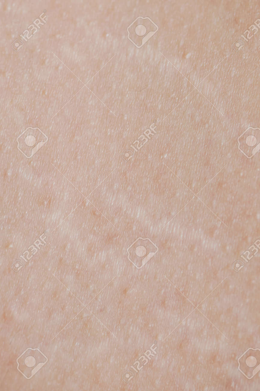 Stretch on human skin background macro close up view - 171393671 Stretch on human skin background macro close up view - 171393671