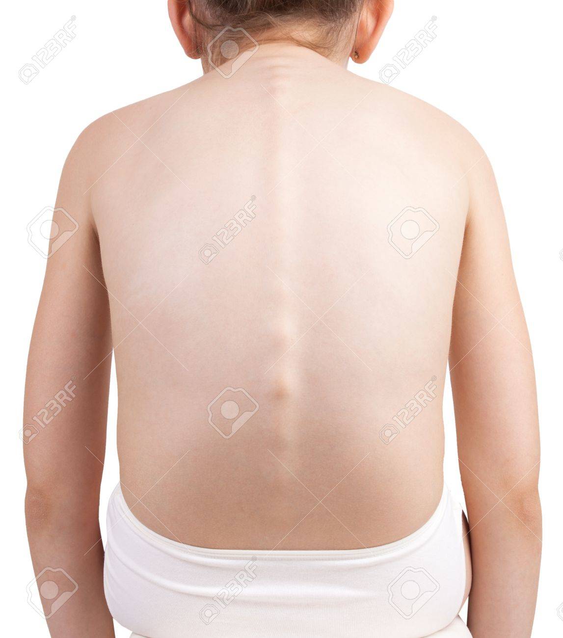 Retour De L Enfant Avec Une Colonne Vertebrale Plat Banque D Images Et Photos Libres De Droits Image