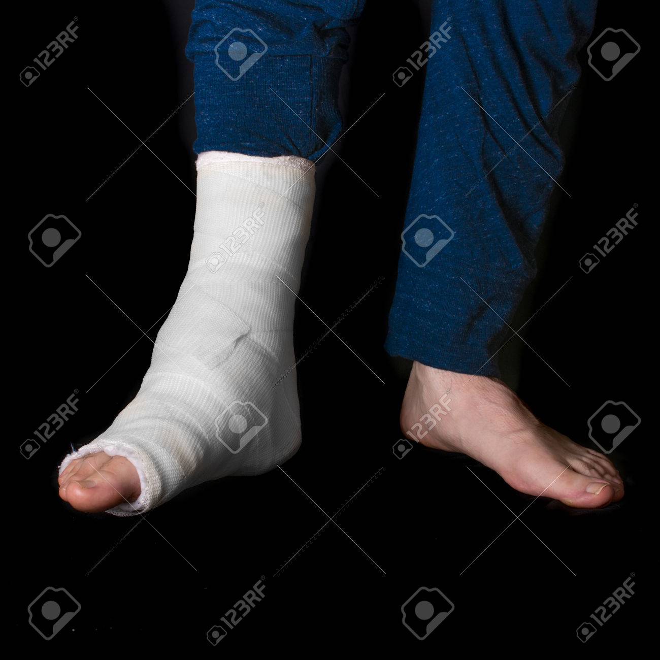 足首を骨折と彼の脚 黒の分離 裸足 キャスト白の若い男 の写真素材 画像素材 Image
