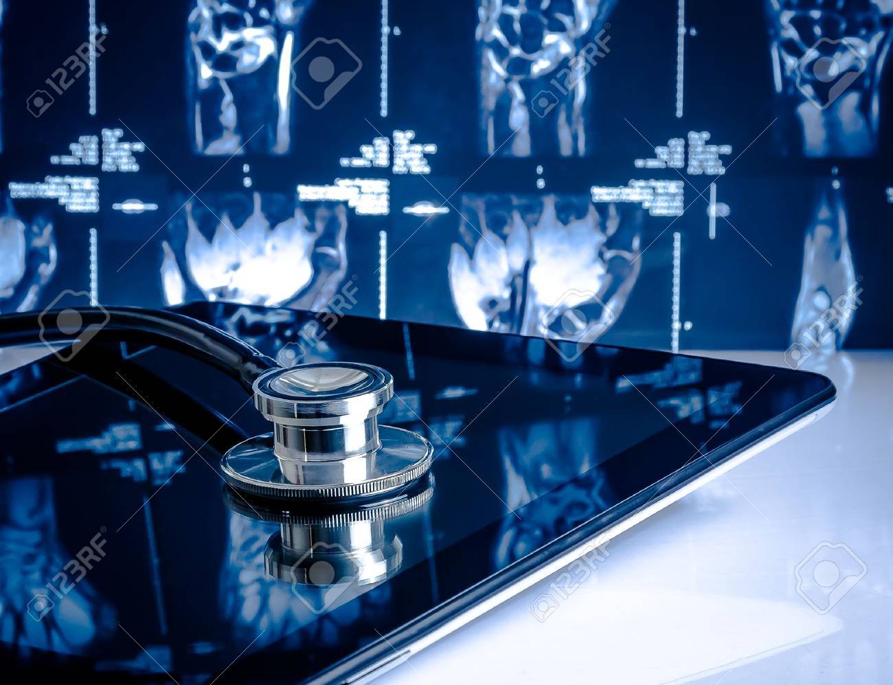medical stethoscope on modern digital tablet in laboratory on x-ray images background. Concept of health care with new technology - 26925793 medical stethoscope on modern digital tablet in laboratory on x-ray images background. Concept of health care with new technology - 26925793