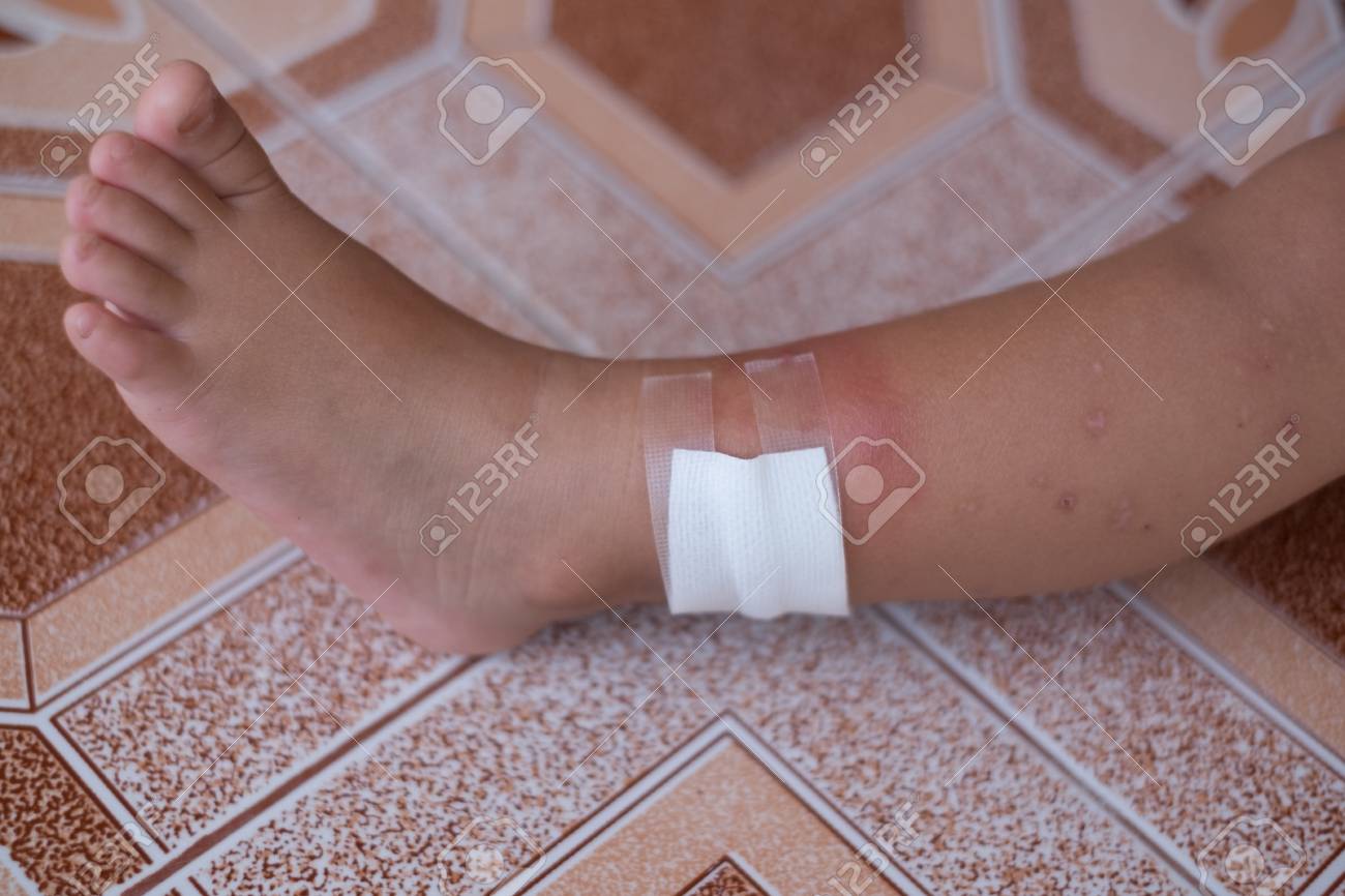 etiam-dictum-ipsum-a-felis