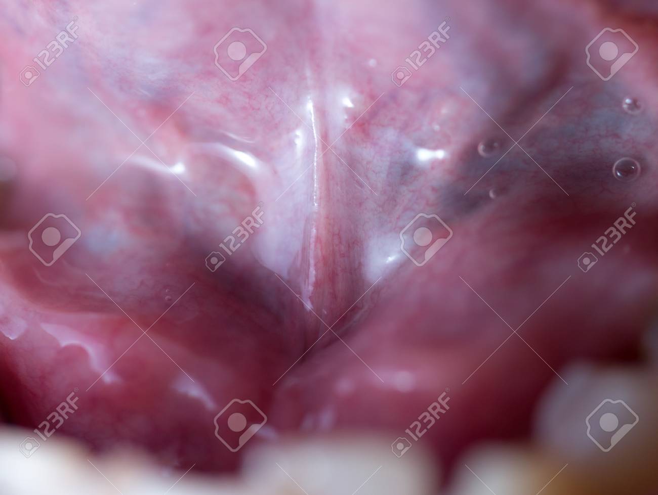 etiam-dictum-ipsum-a-felis