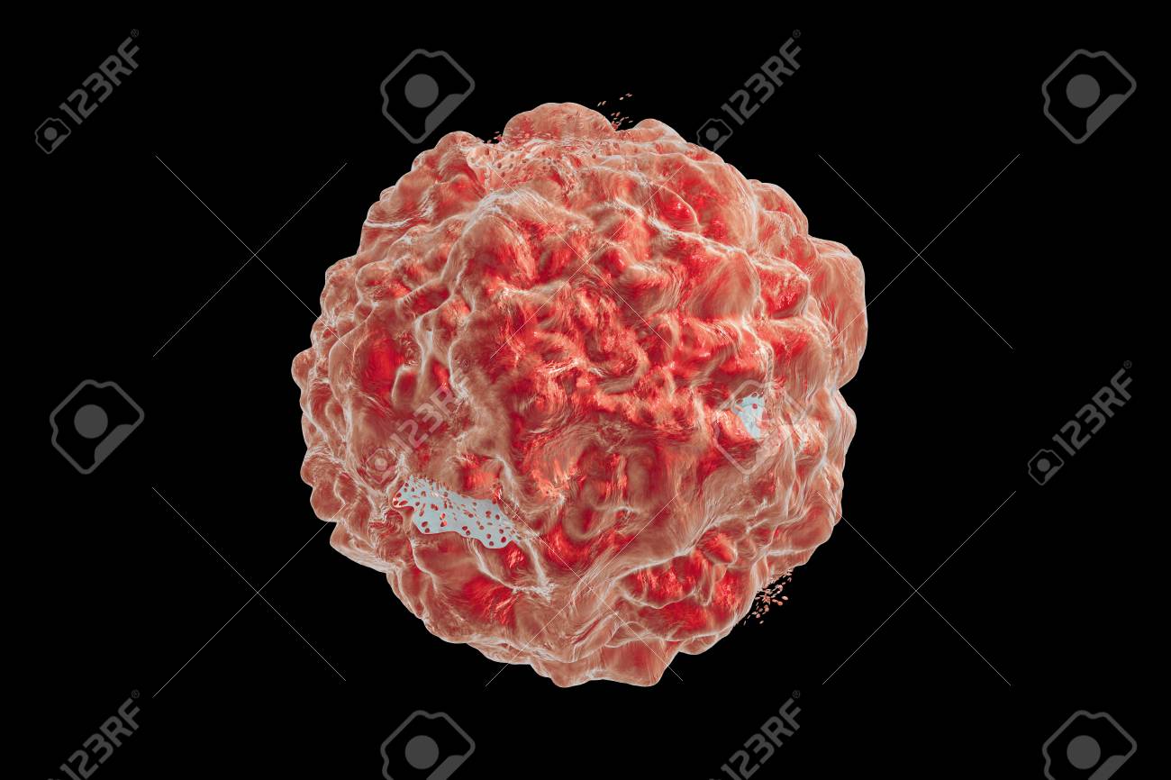 腫瘍細胞の破壊 3 D イラスト 腫瘍細胞の破壊のさまざまな段階を示す画像のシリーズ 薬 薬 微生物 ナノ粒子の効果を説明するために使用することができます の写真素材 画像素材 Image