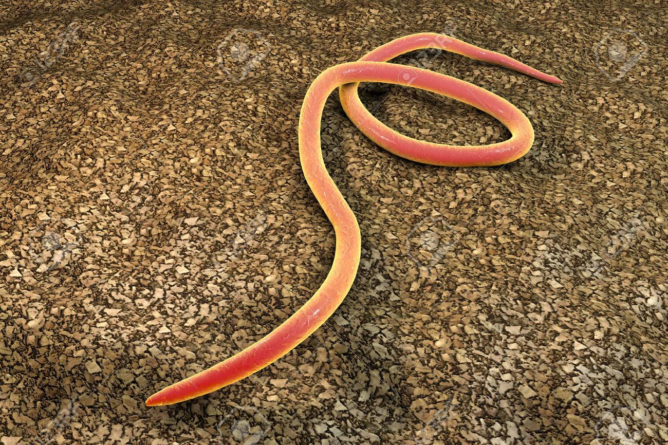 蟯虫 3 D イラストレーションを引き起こす蠕虫蟯虫ぎょう の写真素材 画像素材 Image