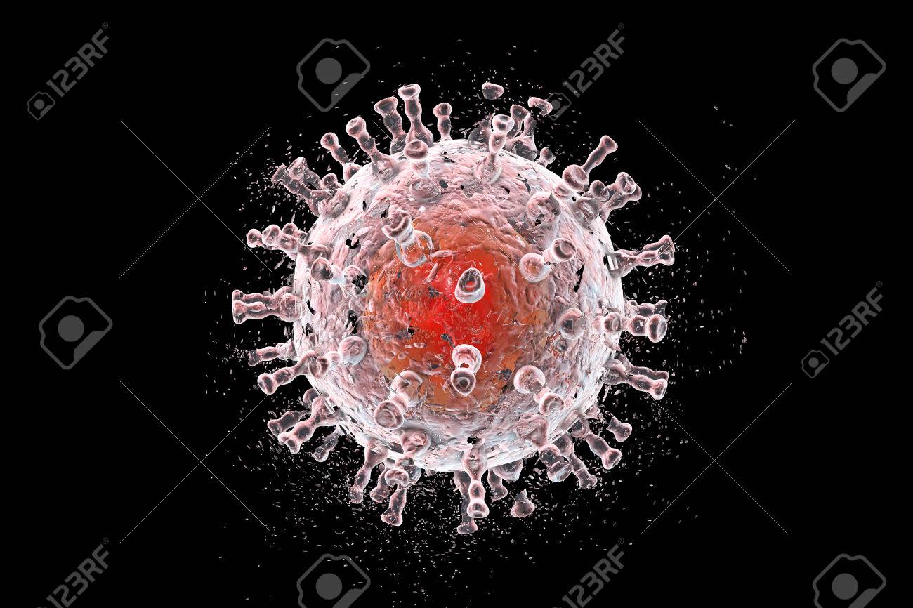 sarcoma de kaposi vih tratamiento