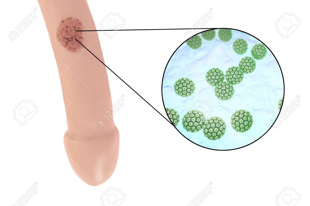 agenți anti nematode