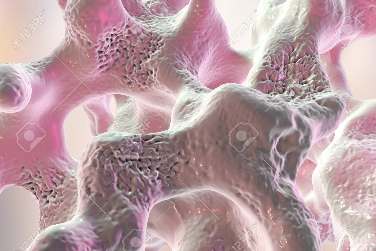 spongy bone tissue affected by osteoporosis 3d illustration stock bone tissue