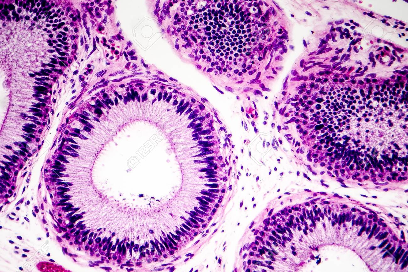 histology of human epididymis tissue micrograph photo under