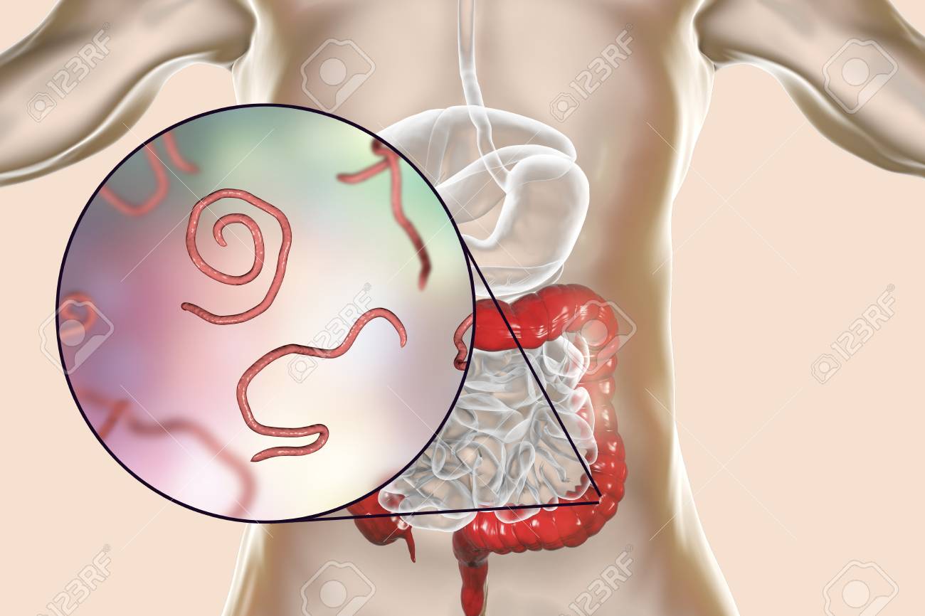 helmint enterobiosis