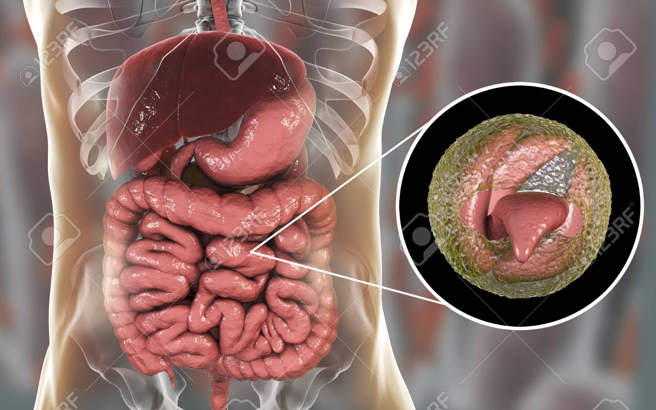 Cryptosporidiosis, A Diarrheal Disease Caused By Cryptosporidium Parvum  Protozoan. 3D Illustration Showing Release Of Parasite Sporozoites From  Oocyst Inside Small Intestine Stock Photo, Picture and Royalty Free Image.  Image 115153549.
