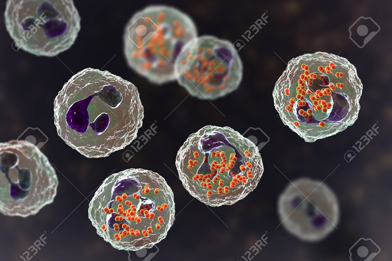 Gonorrhea Poster - Clinical Charts and Supplies, image size:1300x866