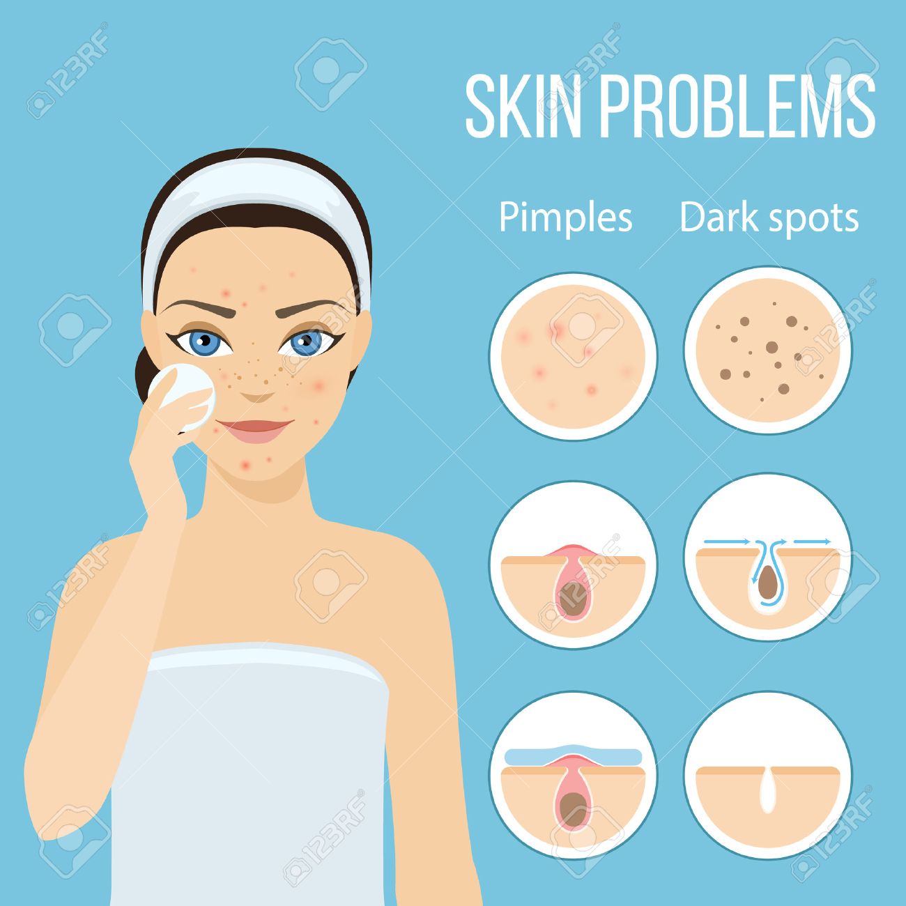 Girl cleans her face with cosmetic lotion. Skin problems solution, home remedies. stock illustration. - 60757523 Girl cleans her face with cosmetic lotion. Skin problems solution, home remedies. stock illustration. - 60757523