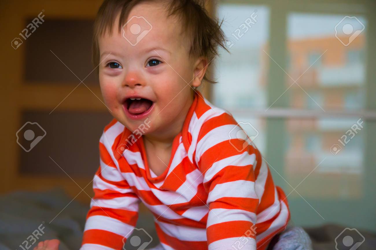 Portrait Of Cute Baby Boy With Down Syndrome Stock Photo Picture And Royalty Free Image Image