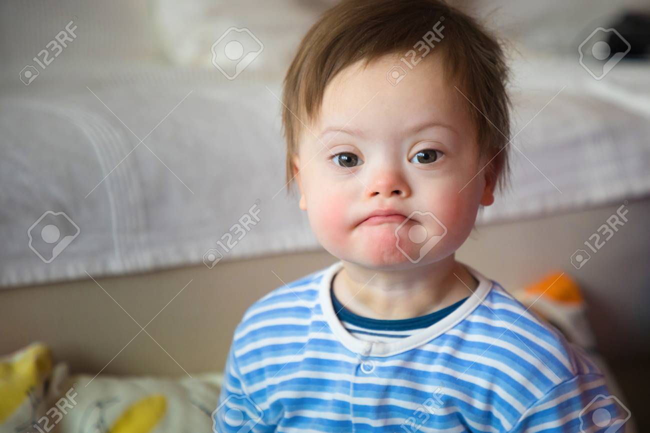 cute down syndrome babies