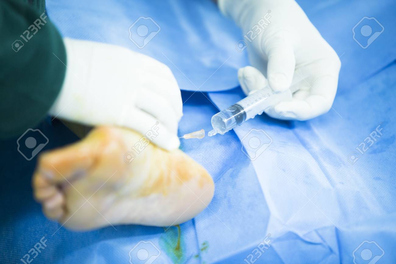 病院緊急整形外科 外傷手術手術室診療実生活写真足 足首および下腿関節鏡の整形手術で の写真素材 画像素材 Image