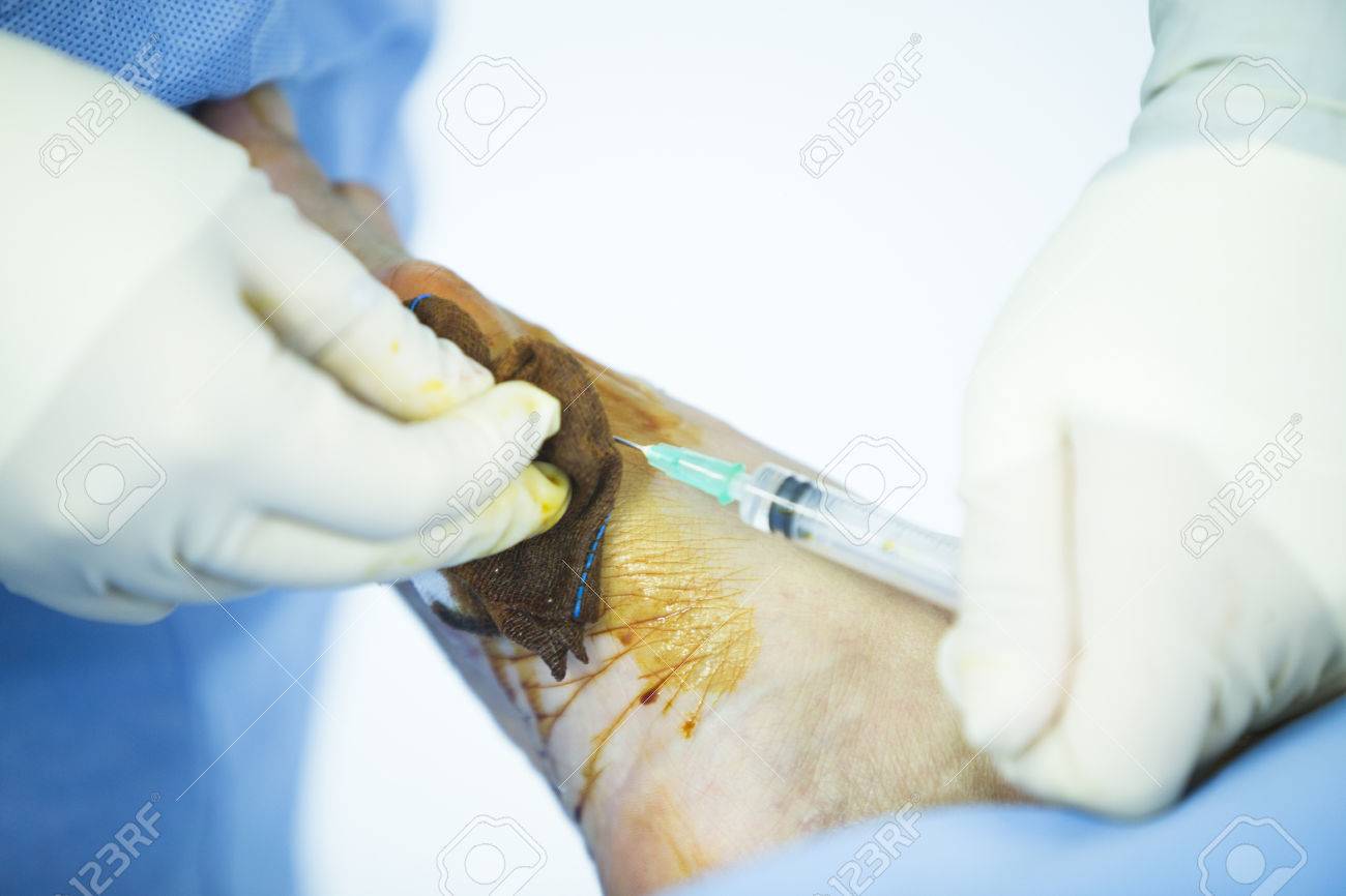 病院緊急整形外科 外傷手術手術室診療実生活写真足 足首および下腿関節鏡の整形手術で の写真素材 画像素材 Image