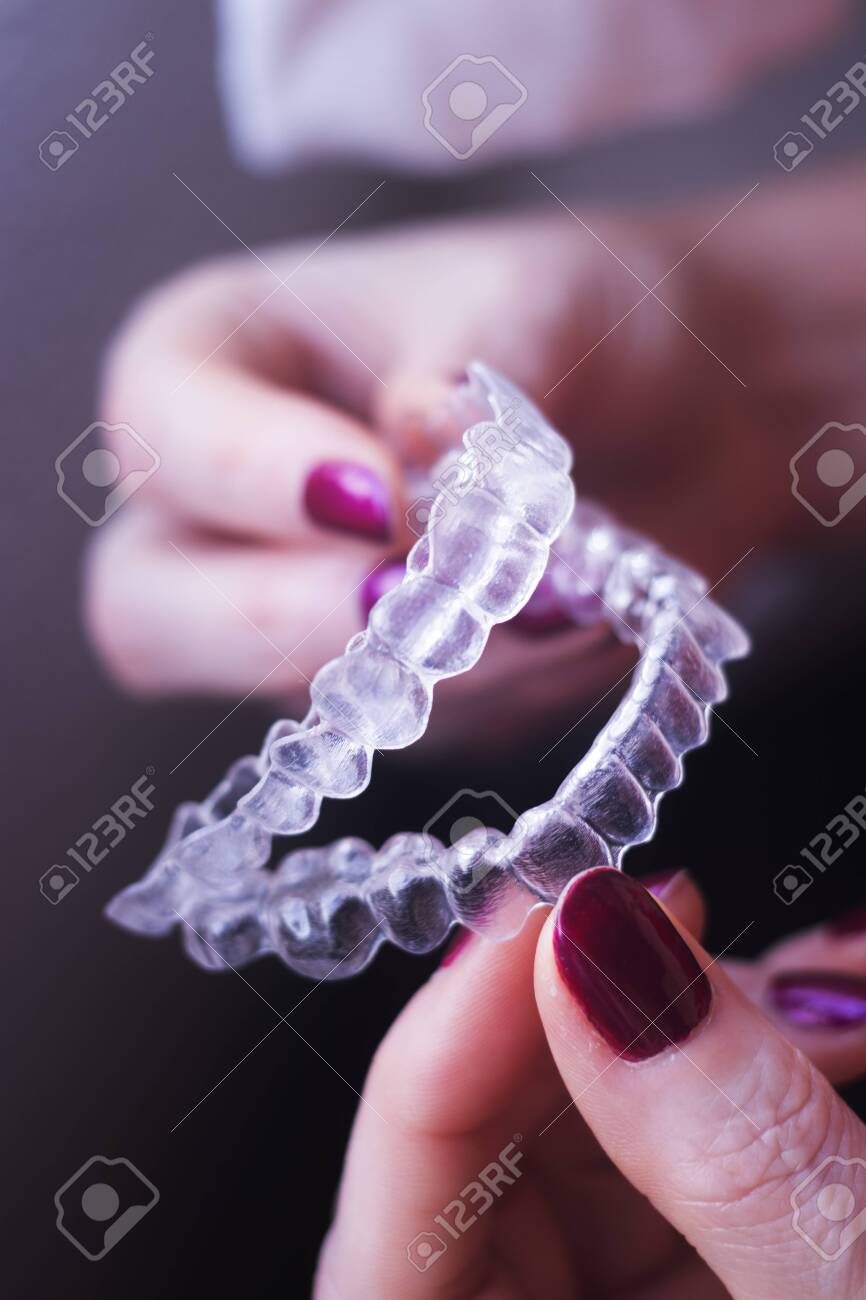 dental teeth alignment