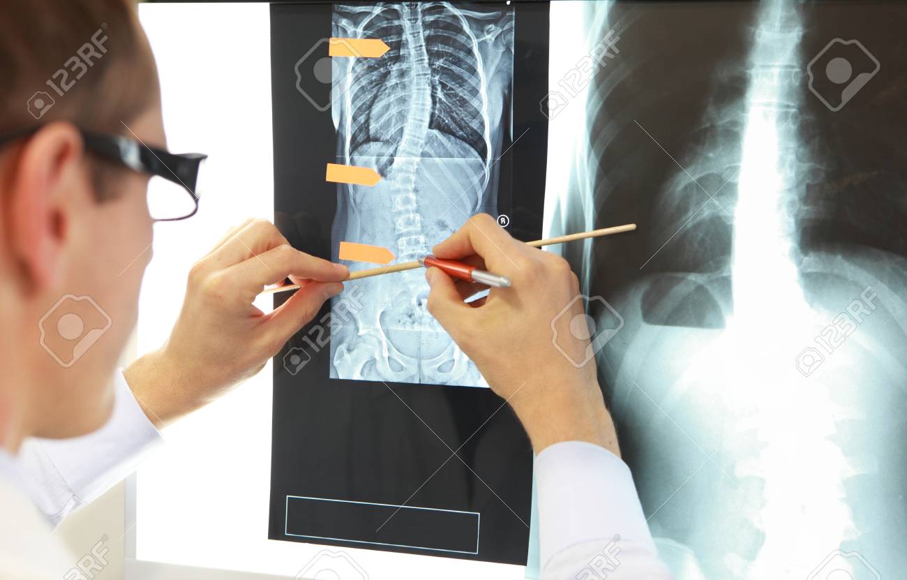 Case study . Doctor working with images of chest and spine at x-ray film viewer,. Diagnosis,treatment planning. - 88935684 Case study . Doctor working with images of chest and spine at x-ray film viewer,. Diagnosis,treatment planning. - 88935684