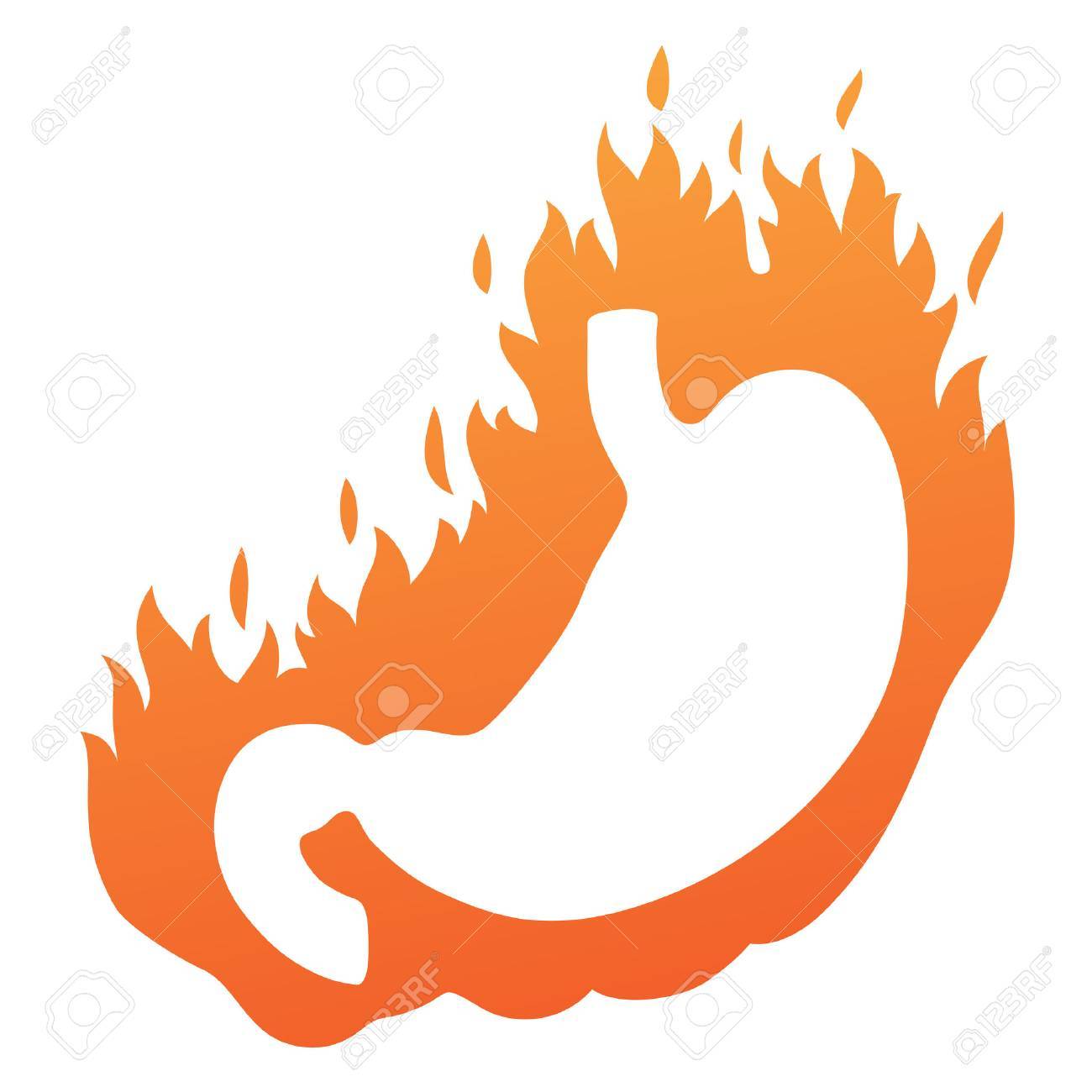 胸焼けと胃のイラストのイラスト素材 ベクタ Image