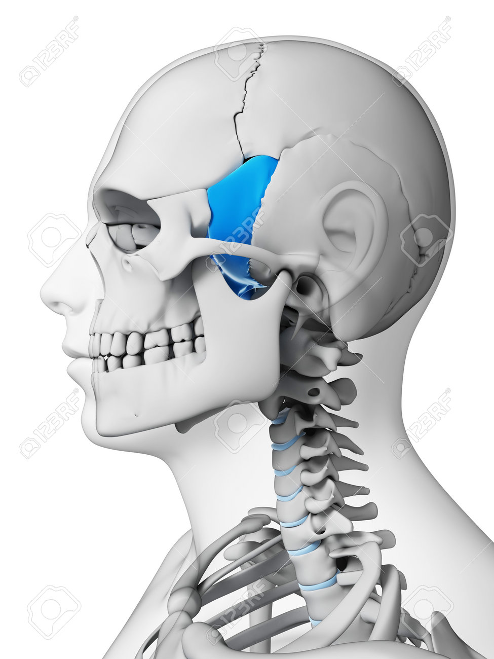 sphenoid bone