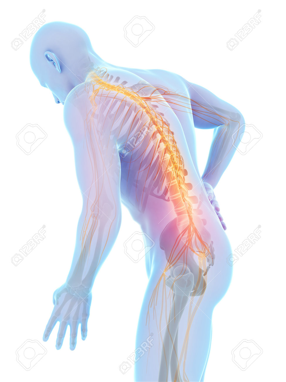 3d rendered illustration - backache male - 18448412 3d rendered illustration - backache male - 18448412