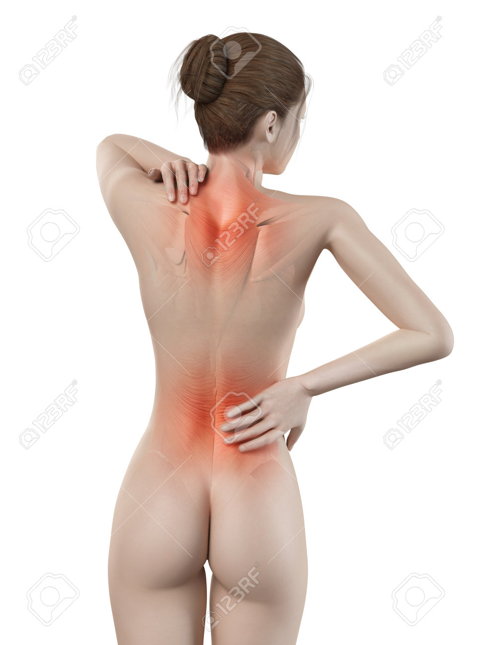 Medical 3d Illustration Female Having Backache Stock Photo Picture And Royalty Free Image Image