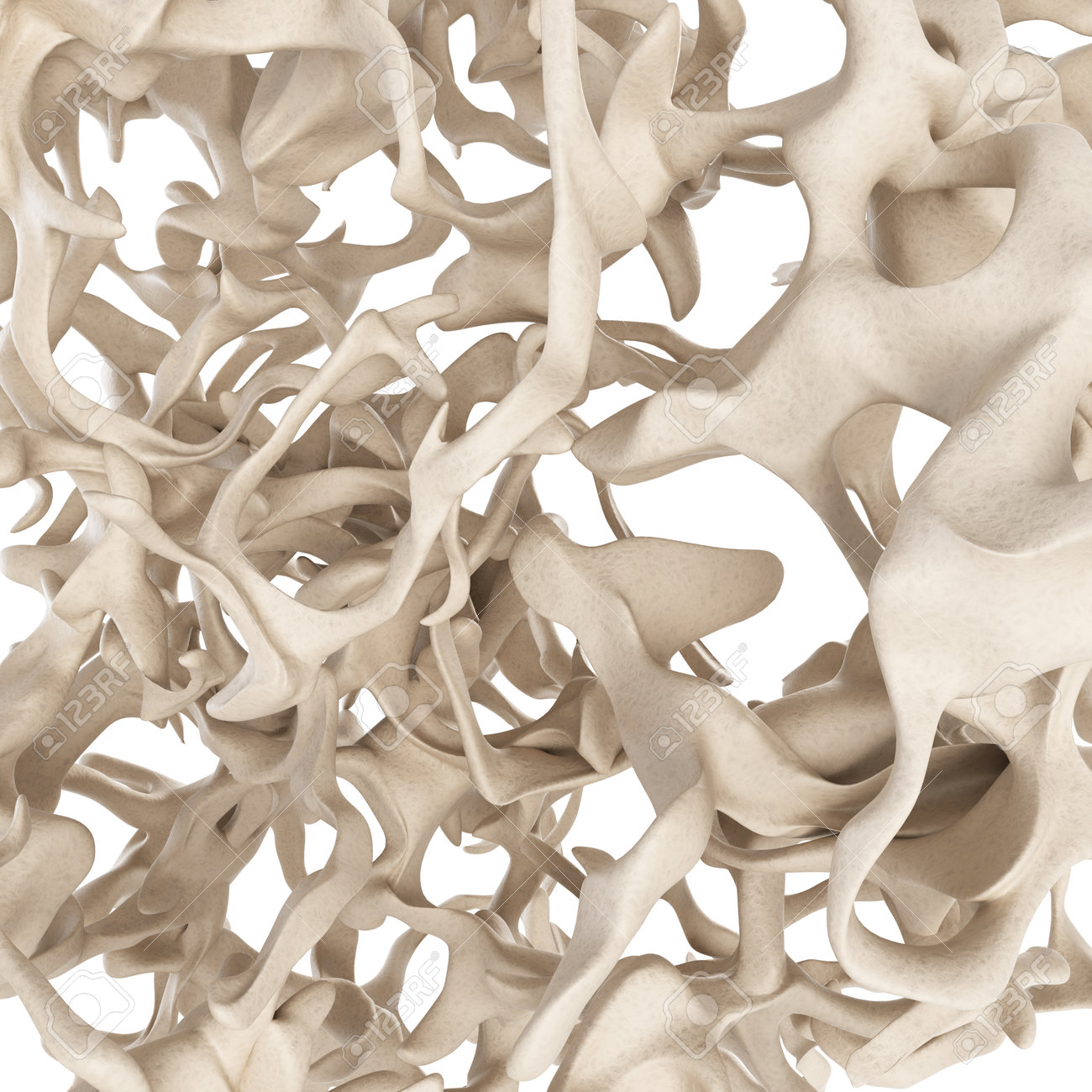 scientific illustration - osteoporosis bone structure - 27227657 scientific illustration - osteoporosis bone structure - 27227657