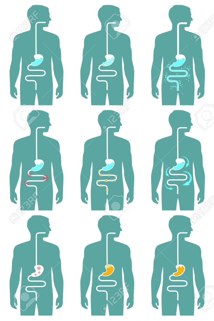 人間の消化器系は 消化管疾患のイラスト のイラスト素材 ベクタ Image