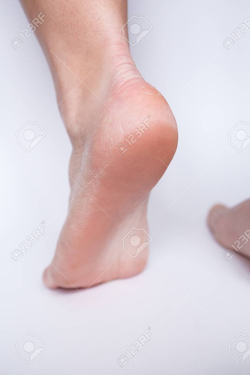 白い背景に乾燥した女性のかかと ヘルスケアとフットケア の写真素材 画像素材 Image