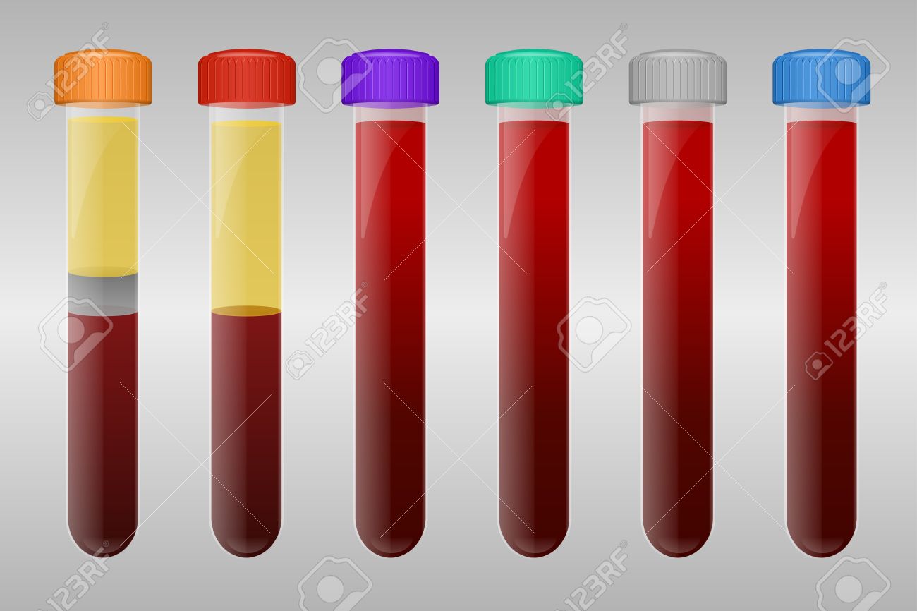 Tubos De Muestras De Sangre Para Los Diferentes Tipos De Análisis De Sangre Ilustraciones Vectoriales Clip Art Vectorizado Libre De Derechos Image 29455149