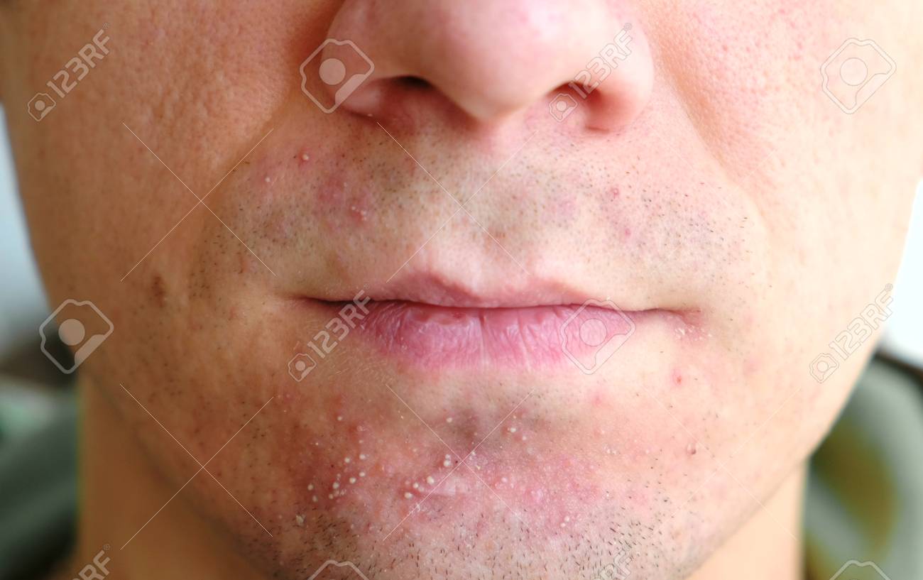 shave nose