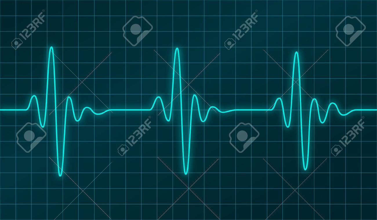 heart beats cardiogram or oscillation signal graph on electronic