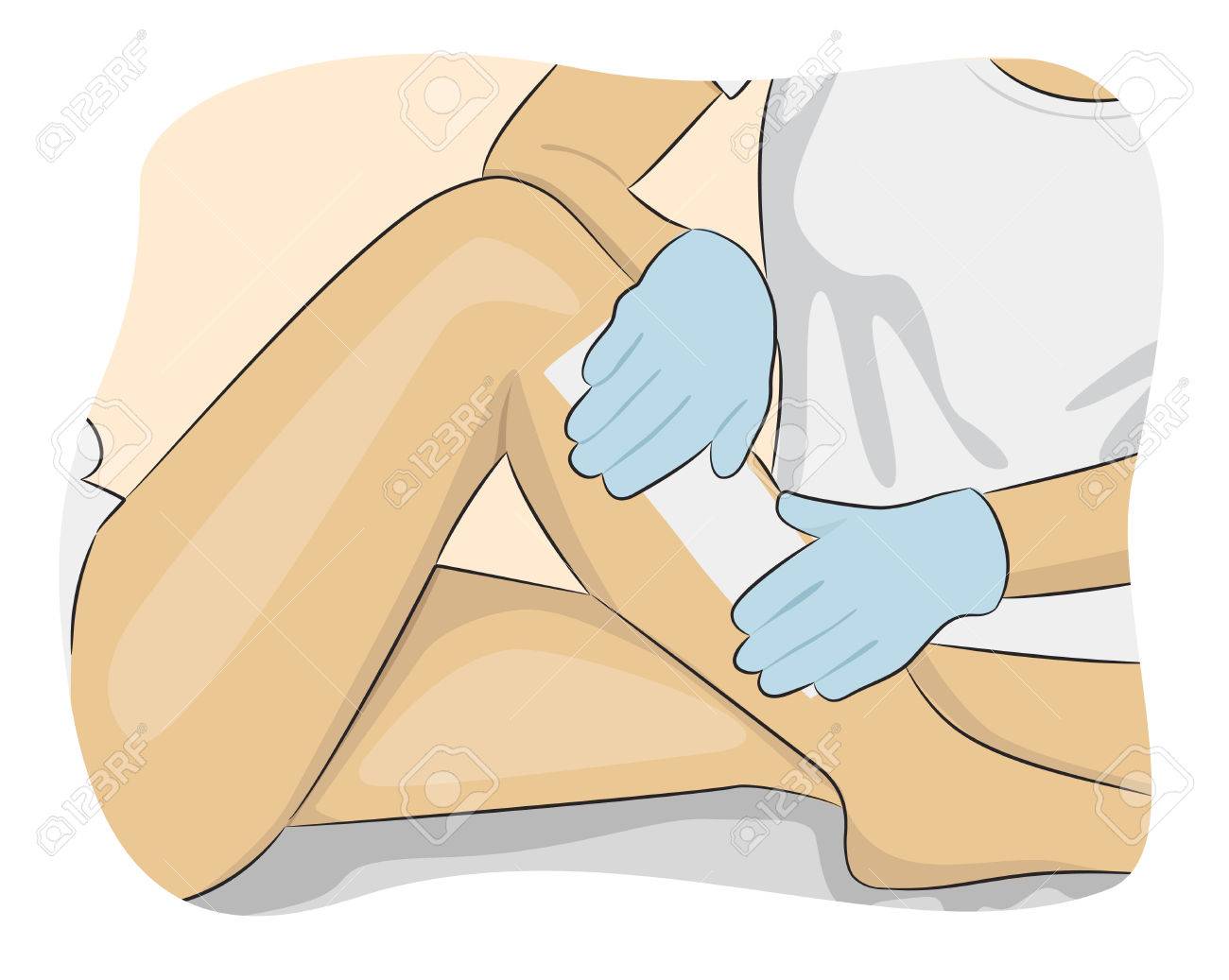 Beautician Waxing A Woman's Leg Applying A Strip Of Material Over The Hot  Wax To Remove The Hairs When Pulled Royalty Free SVG, Cliparts, Vectors,  and Stock Illustration. Image 58217677., image size:1300x1037
