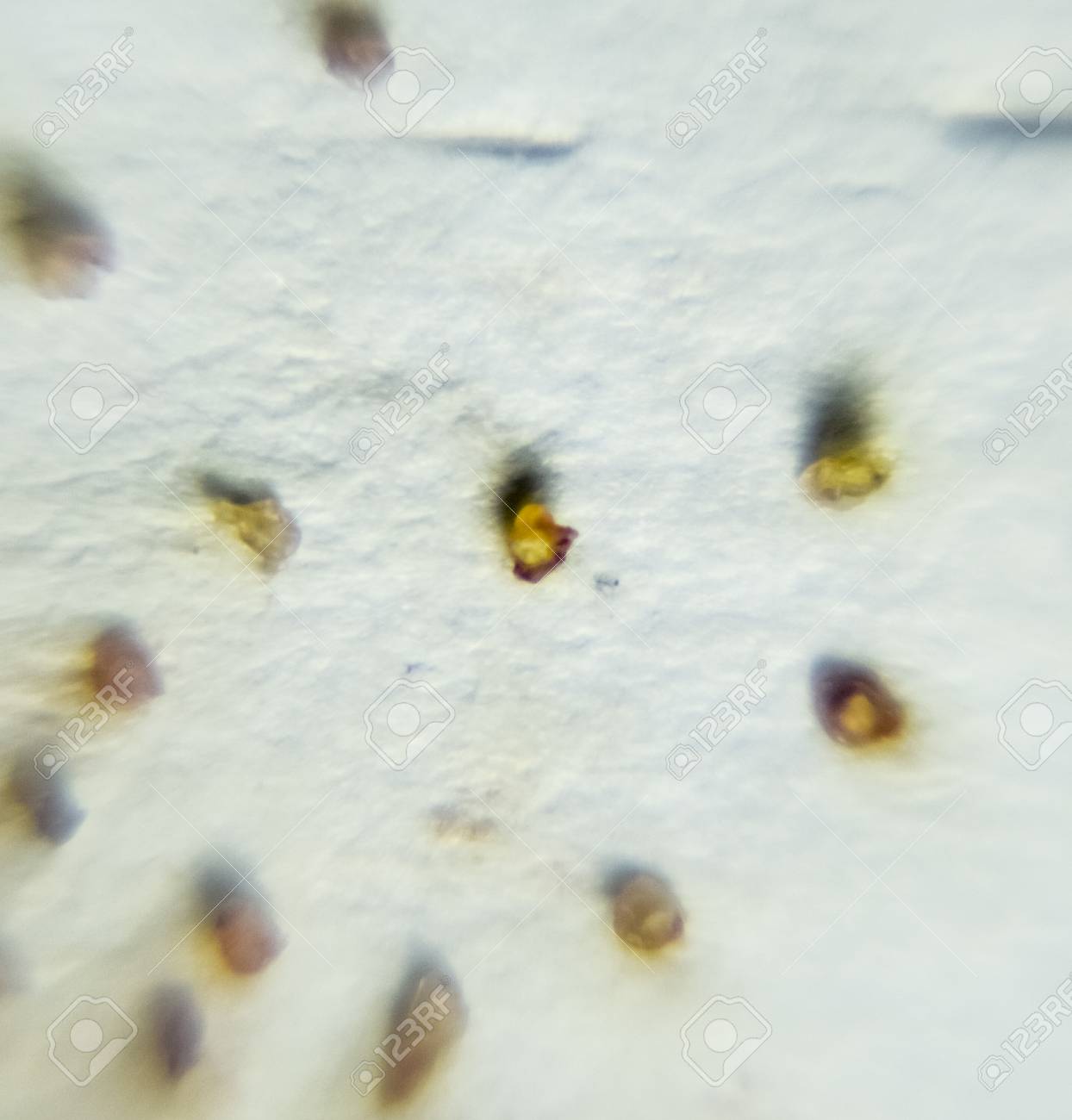 Skin Parasites >> Parasites On A Sheet Of Paper Extruded From The Skin Parasites Skin Parasites >> Parasites On A Sheet Of Paper Extruded From The Skin Parasites