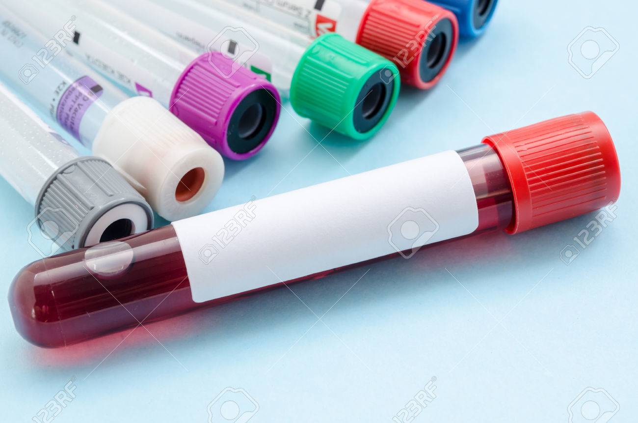 vacuum tubes for collecting blood samples for screening test. - 44441378 vacuum tubes for collecting blood samples for screening test. - 44441378