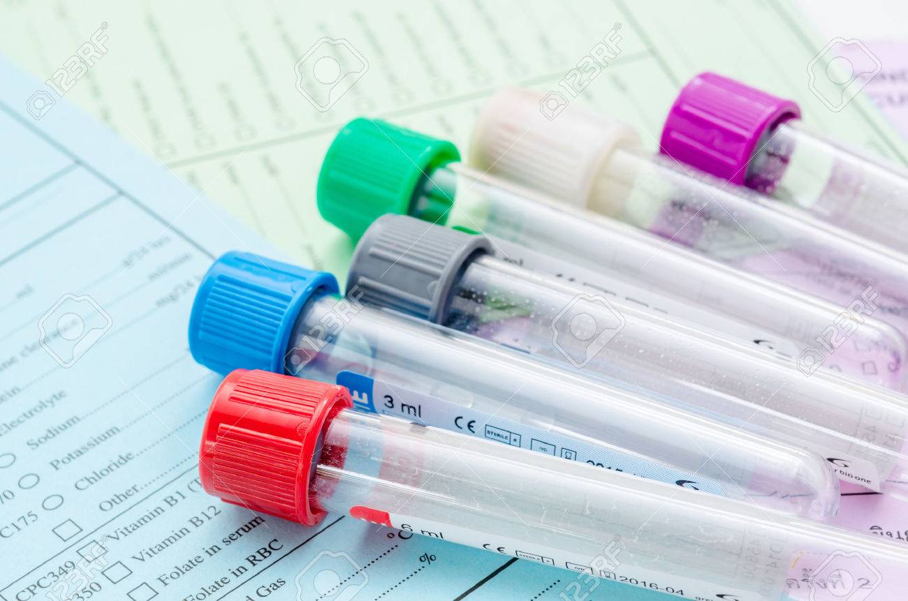 Many empty tubes for blood test screening on form screening background. - 44441267 Many empty tubes for blood test screening on form screening background. - 44441267