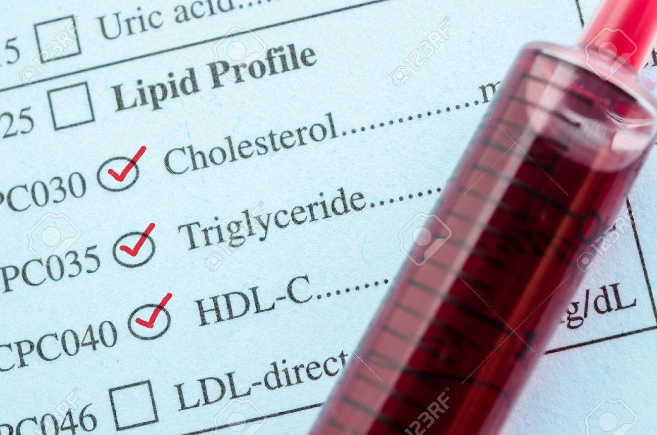 Red mark check on Cholesterol, Triglyceride and HDL-Con request form with blood sample in blood tube for test. - 57770637 Red mark check on Cholesterol, Triglyceride and HDL-Con request form with blood sample in blood tube for test. - 57770637
