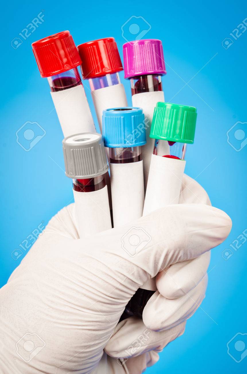 Hand holding Vacuum tubes for collecting blood samples in the laboratory. - 82028362 Hand holding Vacuum tubes for collecting blood samples in the laboratory. - 82028362