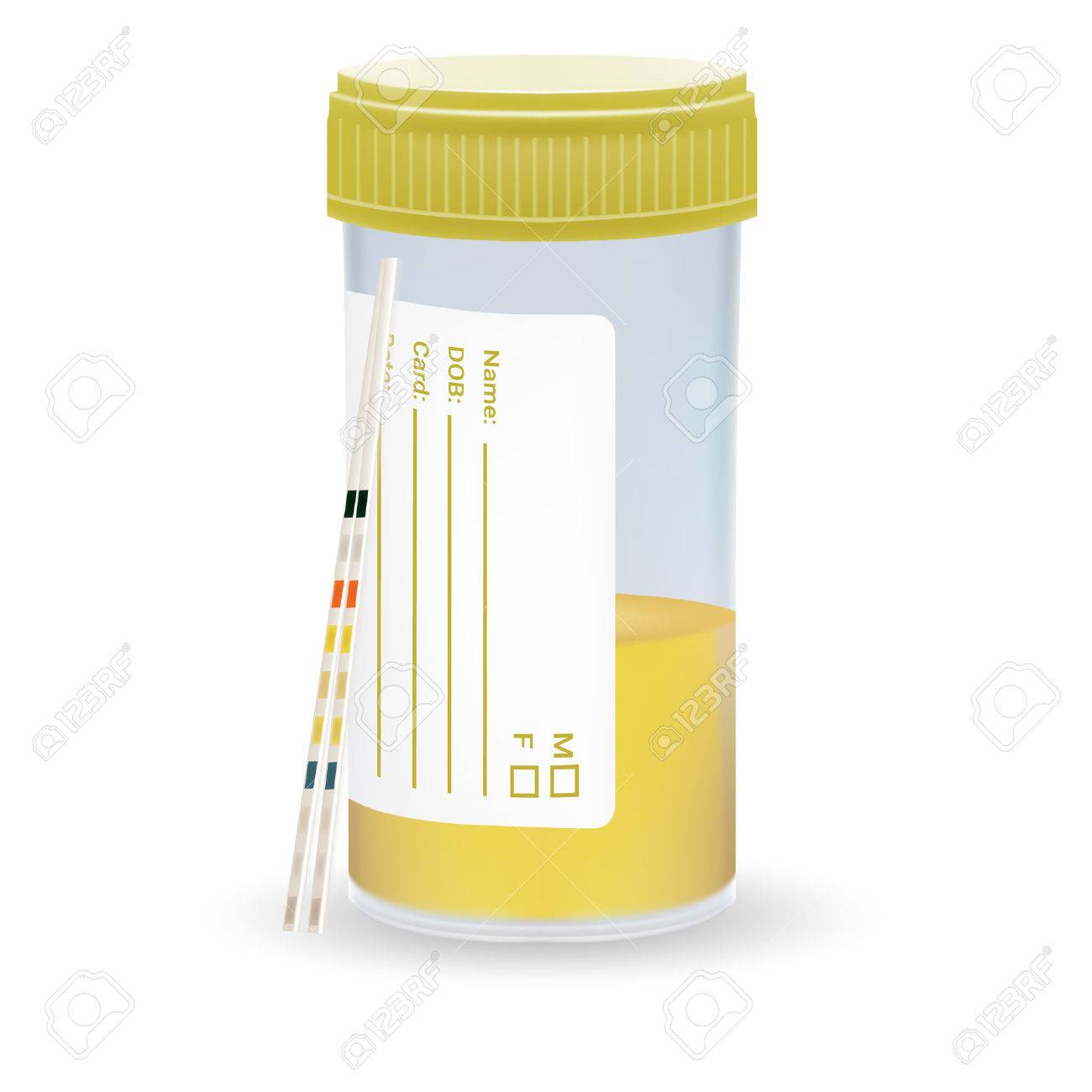 Ph Teststrips Lakmoespapier En Urine In Testkruik Geisoleerd Op Een Witte Achtergrond Realistische Vectorillustratie Royalty Vrije Cliparts Vectoren En Stock Illustratie Image 82035954