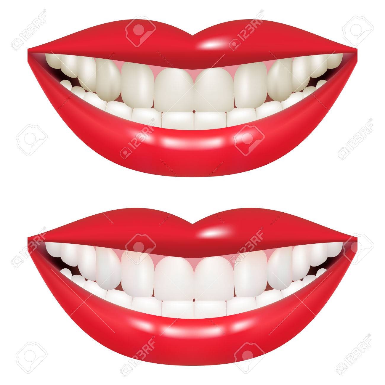 歯のホワイトニングの前後に 女性の口は白い背景に分離されました リアルなベクター イラストです 医療口腔病学 イラスト専門の歯のクリーニングします の イラスト素材 ベクタ Image