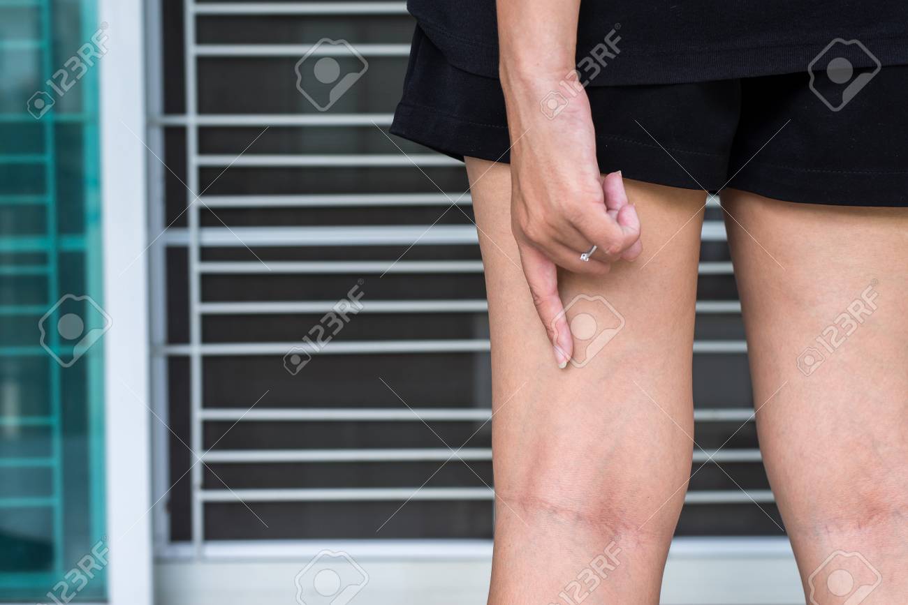 etiam-dictum-ipsum-a-felis