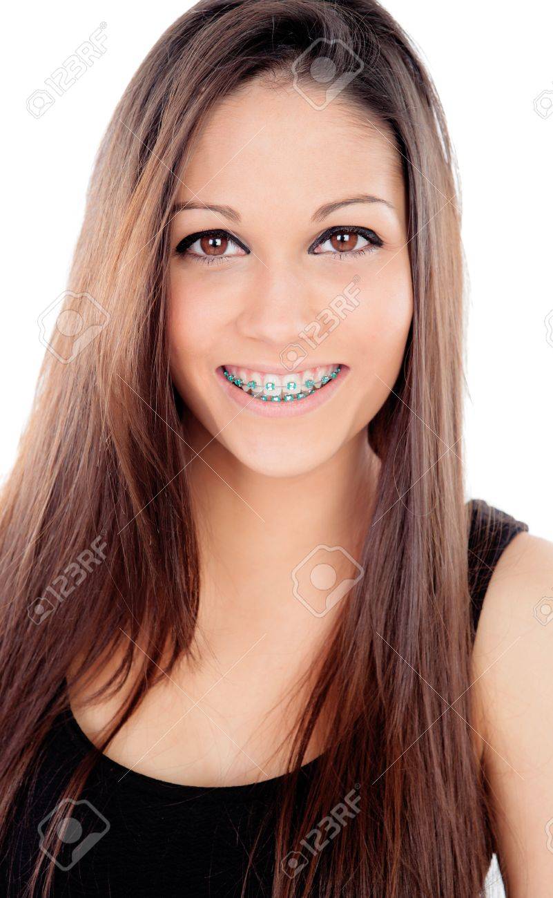 Attractive Smiling Girl With Brackets 