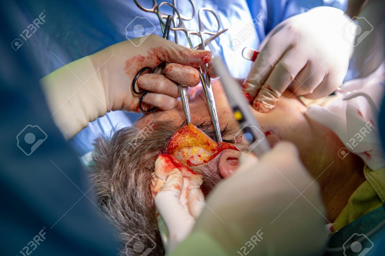 etiam-dictum-ipsum-a-felis