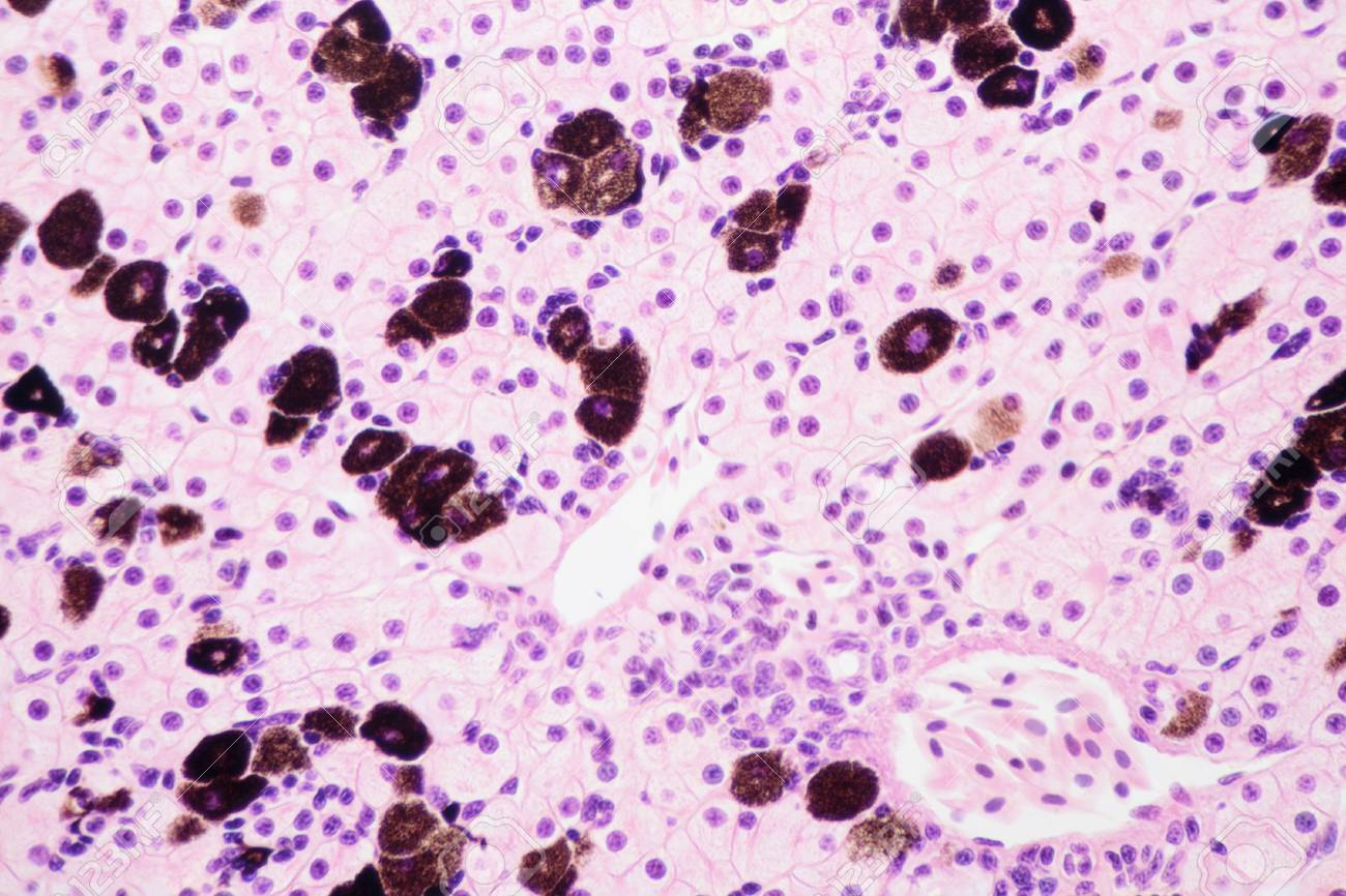 Light Microscope View Of Liver Cells Stock Photo Picture And Royalty Free Image Image Light Microscope View Of Liver Cells Stock Photo Picture And Royalty Free Image Image