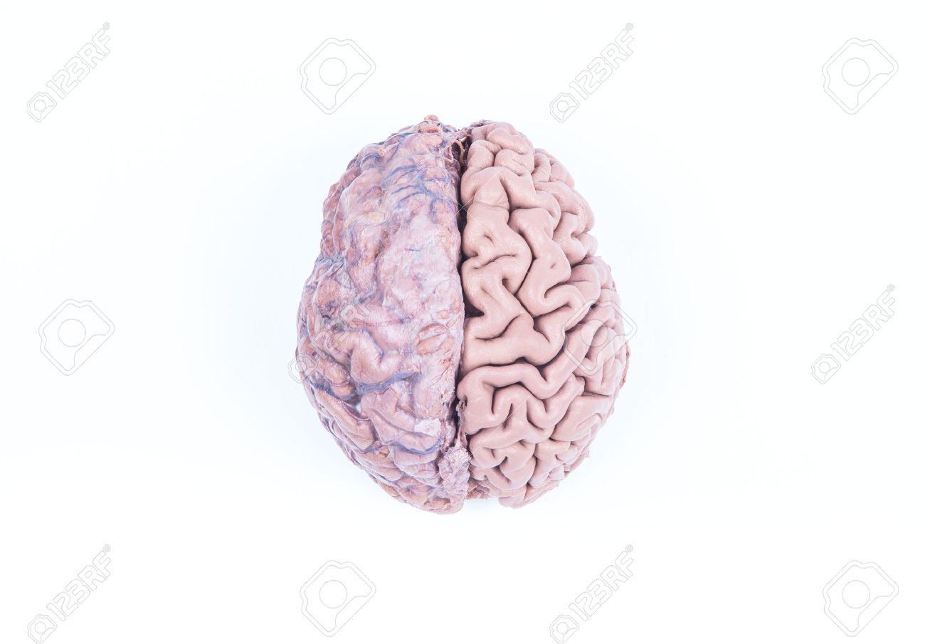 白で隔離される本物の人間の脳の両半球 の写真素材・画像素材. Image 