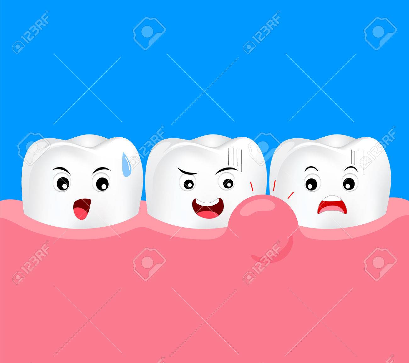 imagenes de encias hinchadas