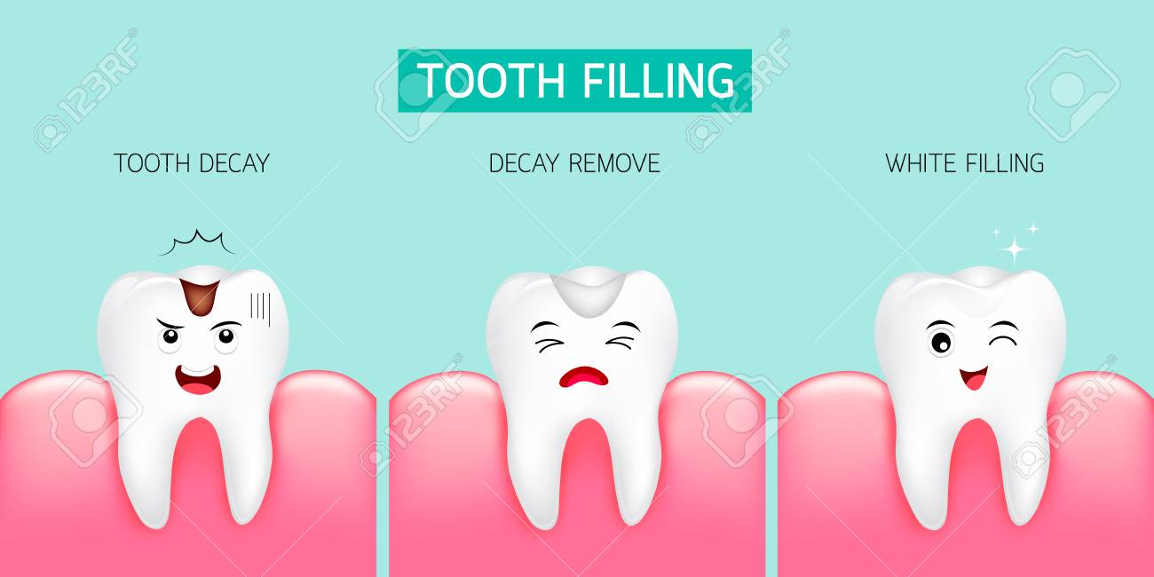 歯の充填の手順です 虫歯 虫歯削除および白い充填 かわいい漫画のデザイン イラストの緑の背景に分離されました 歯科治療のコンセプトです のイラスト素材 ベクタ Image 歯の充填の手順です 虫歯 虫歯削除および白い充填 かわいい漫画のデザイン イラストの緑の背景に分離されました 歯科治療のコンセプトです のイラスト素材 ベクタ Image