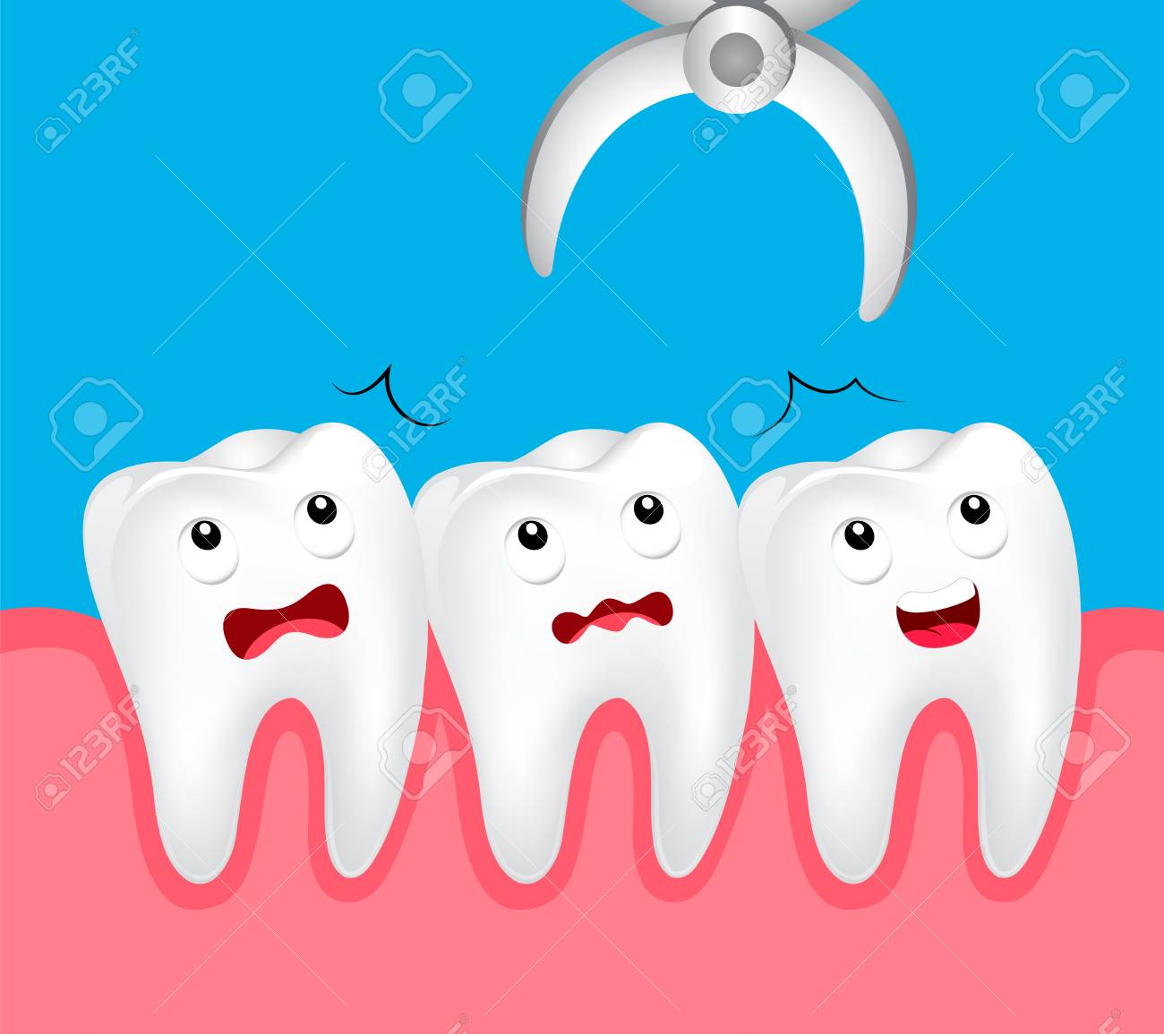 かわいい漫画の歯の抽出 歯の除去 歯科問題の概念 イラスト のイラスト素材 ベクタ Image