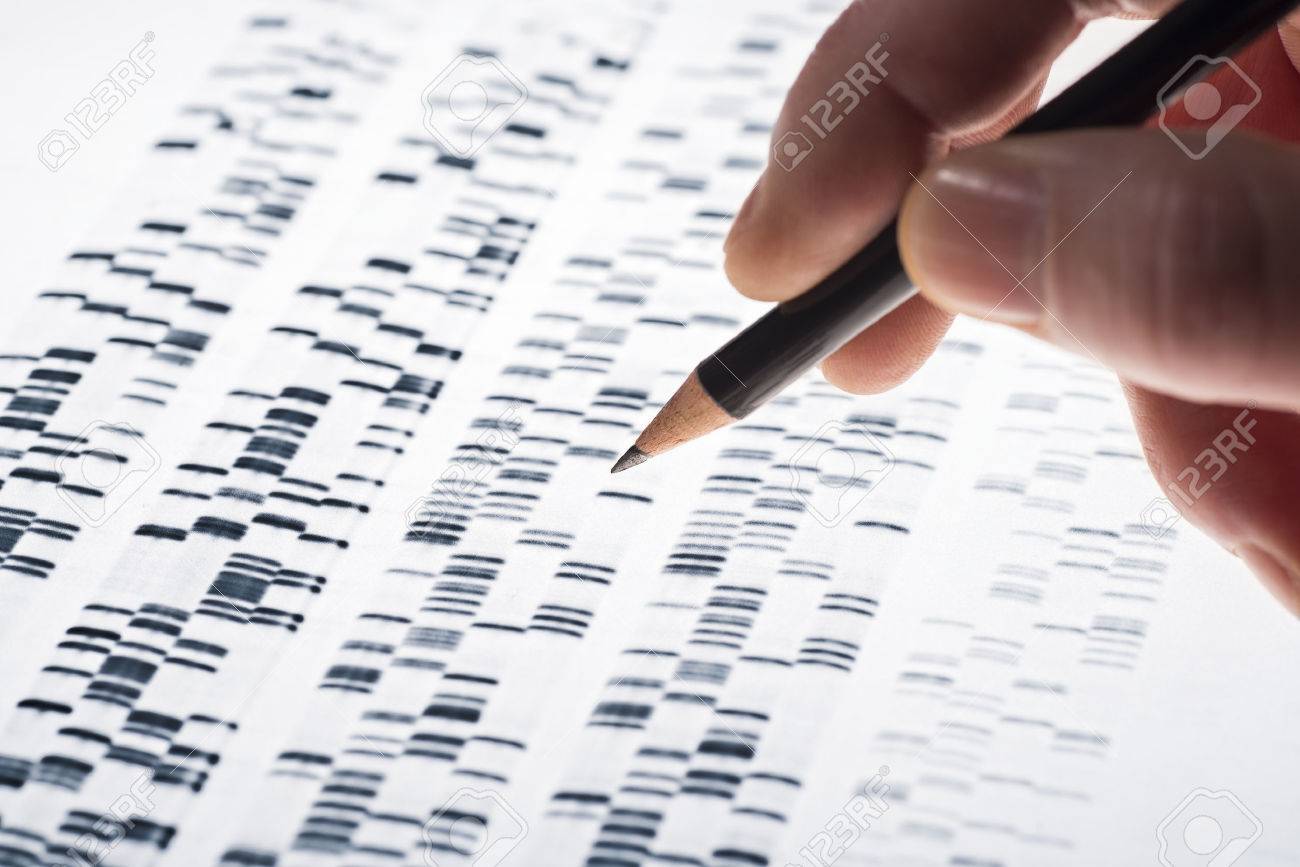 Scientists examined DNA gel that is used in genetics, medicine, biology, pharma research and forensics. - 37239059 Scientists examined DNA gel that is used in genetics, medicine, biology, pharma research and forensics. - 37239059