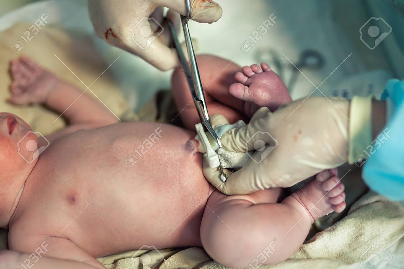 Close Up Doctor Obstetrician Nurse Cutting Umbilical Cord With Stock Photo Picture And Royalty Free Image Image 142250226